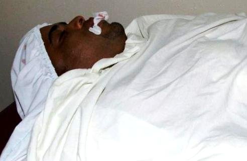 Cadaver sin vida de Tito